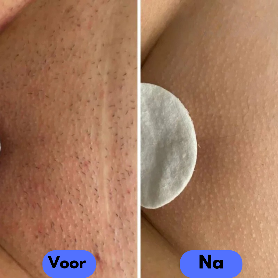 Tails Hair Removal Device