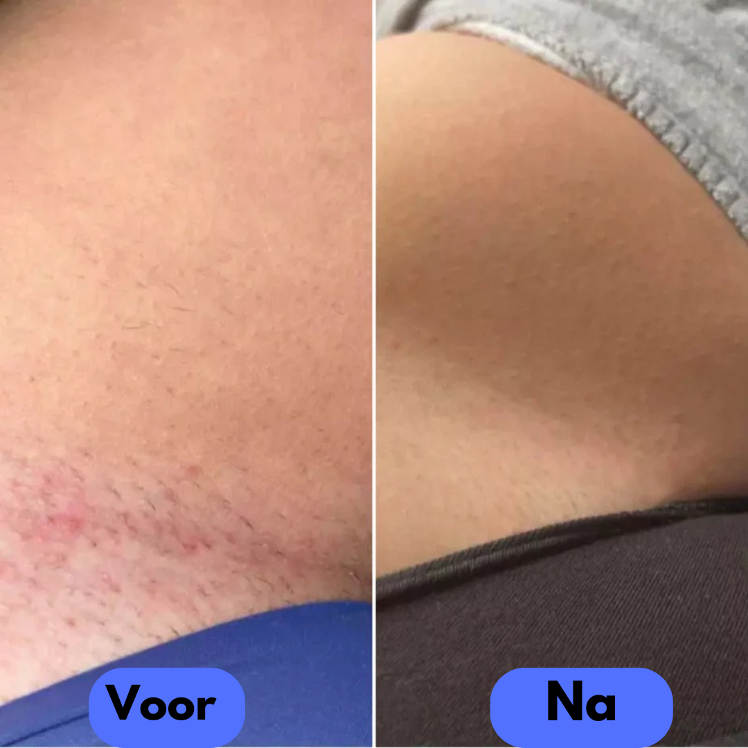 Tails Hair Removal Device